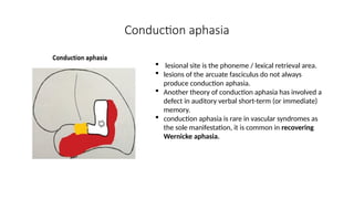 Conduction aphasia
 lesional site is the phoneme / lexical retrieval area.
 lesions of the arcuate fasciculus do not always
produce conduction aphasia.
 Another theory of conduction aphasia has involved a
defect in auditory verbal short-term (or immediate)
memory.
 conduction aphasia is rare in vascular syndromes as
the sole manifestation, it is common in recovering
Wernicke aphasia.
 