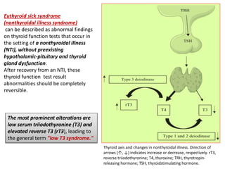 Thyroid axis and changes in nonthyroidal illness. Direction of
arrows (↑, ↓) indicates increase or decrease, respectively. rT3,
reverse triiodothyronine; T4, thyroxine; TRH, thyrotropin-
releasing hormone; TSH, thyroidstimulating hormone.
Euthyroid sick syndrome
(nonthyroidal illness syndrome)
can be described as abnormal findings
on thyroid function tests that occur in
the setting of a nonthyroidal illness
(NTI), without preexisting
hypothalamic-pituitary and thyroid
gland dysfunction.
After recovery from an NTI, these
thyroid function test result
abnormalities should be completely
reversible.
The most prominent alterations are
low serum triiodothyronine (T3) and
elevated reverse T3 (rT3), leading to
the general term "low T3 syndrome."
 
