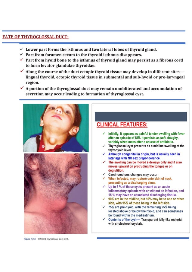 Thyroglossal duct cysts