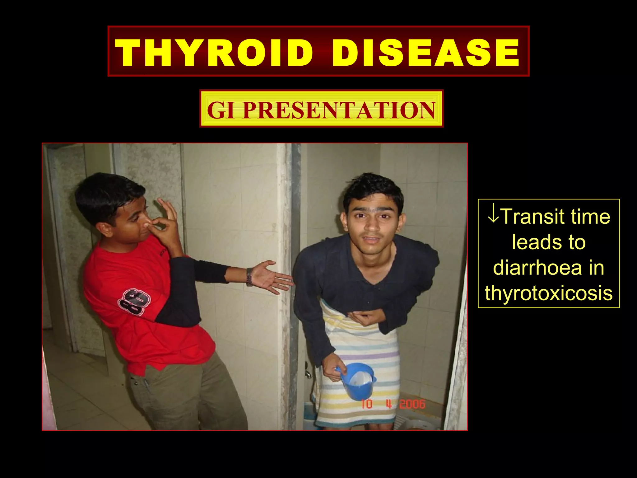 THYROID DISEASE
   GI PRESENTATION



                     ↓Transit time
                        leads to
                      diarrhoea in
                     thyrotoxicosis
 