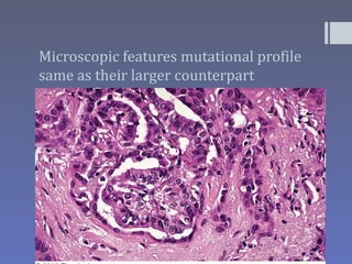 Microscopic features mutational profile
same as their larger counterpart
 