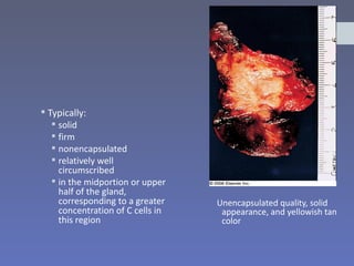  Typically:
    solid
    firm
    nonencapsulated
    relatively well
     circumscribed
    in the midportion or upper
     half of the gland,
     corresponding to a greater    Unencapsulated quality, solid
     concentration of C cells in    appearance, and yellowish tan
     this region                    color
 