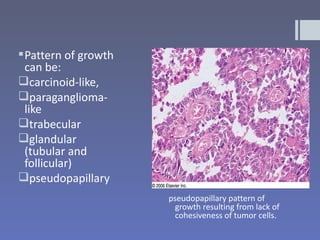  Pattern of growth
  can be:
carcinoid-like,
paraganglioma-
  like
trabecular
glandular
  (tubular and
  follicular)
pseudopapillary
                      pseudopapillary pattern of
                        growth resulting from lack of
                        cohesiveness of tumor cells.
 