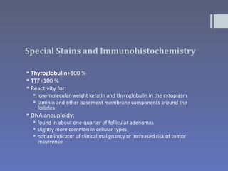 Special Stains and Immunohistochemistry

 Thyroglobulin+100 %
 TTF+100 %
 Reactivity for:
   low-molecular-weight keratin and thyroglobulin in the cytoplasm
   laminin and other basement membrane components around the
    follicles
 DNA aneuploidy:
   found in about one-quarter of follicular adenomas
   slightly more common in cellular types
   not an indicator of clinical malignancy or increased risk of tumor
    recurrence
 