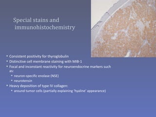 Special stains and
    immunohistochemistry



 Consistent positivity for thyroglobulin
 Distinctive cell membrane staining with MIB-1
 Focal and inconstant reactivity for neuroendocrine markers such
  as:
   neuron-specific enolase (NSE)
   neurotensin
 Heavy deposition of type IV collagen:
   around tumor cells (partially explaining ‘hyaline’ appearance)
 