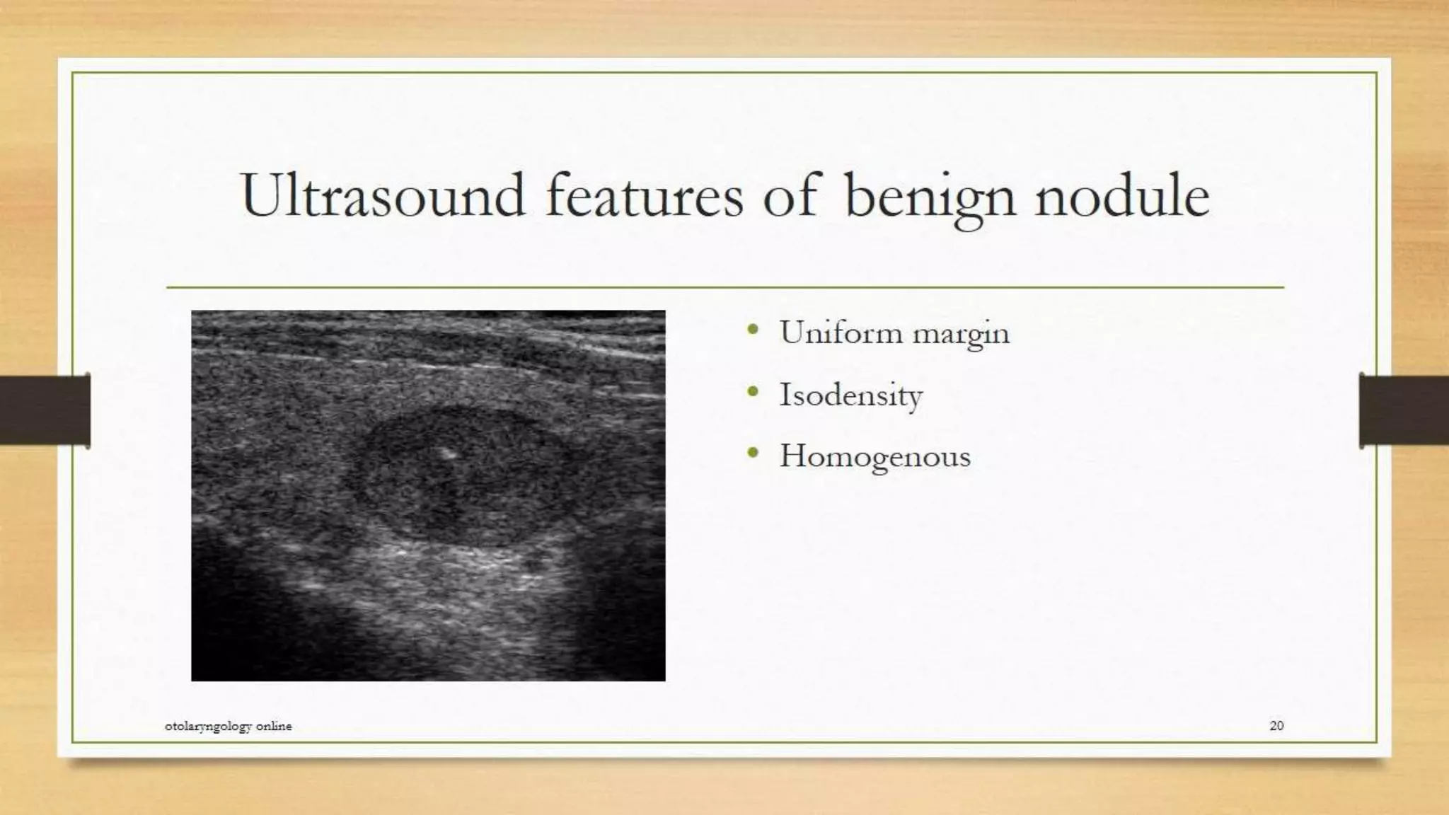 Thyroid nodule management