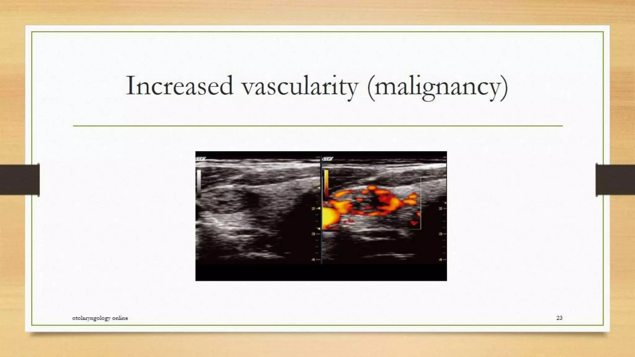 Thyroid nodule management