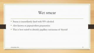Thyroid nodule management