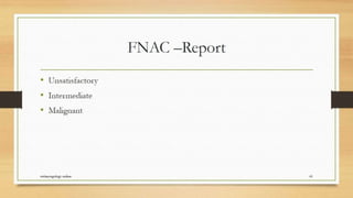 Thyroid nodule management