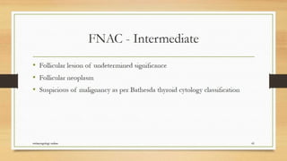 Thyroid nodule management