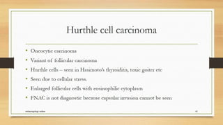 Thyroid nodule management