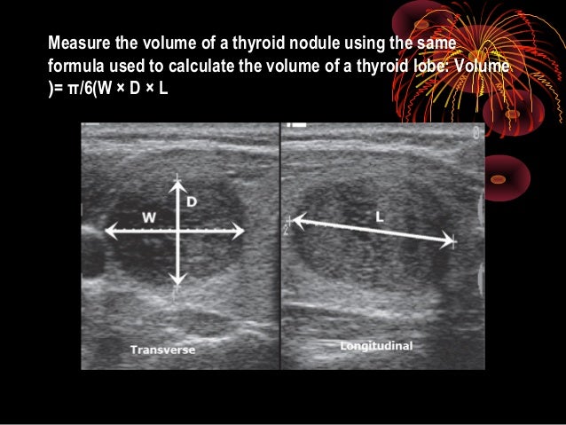 Thyroid Ultrasound Measurements