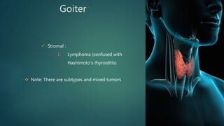 Goiter
 Stromal :
I. Lymphoma (confused with
Hashimoto’s thyroiditis)
 Note: There are subtypes and mixed tumors
 