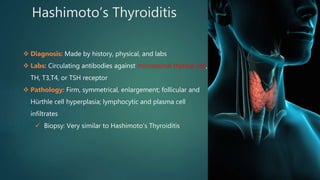 Hashimoto’s Thyroiditis
 Diagnosis: Made by history, physical, and labs
 Labs: Circulating antibodies against microsomal thyroid cell,
TH, T3,T4, or TSH receptor
 Pathology: Firm, symmetrical, enlargement; follicular and
Hürthle cell hyperplasia; lymphocytic and plasma cell
infiltrates
 Biopsy: Very similar to Hashimoto’s Thyroiditis
 