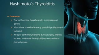 Hashimoto’s Thyroiditis
 Treatment:
 Thyroid hormone (usually results in regression of
goiter)
 With failure o medical therapy, partial thyroidectomy is
indicated
 If biopsy confirms lymphoma during surgery, there is
no need to remove the thyroid (very responsive to
chemotherapy)
 