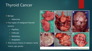 Thyroid Cancer
 Benign:
 Adenoma
 Four types of malignant thyroid
tumors:
 Papillary
 Follicular
 Medullary
 Anaplastic
 Risk Factors: History of radiation, family
history, age, gender.
 