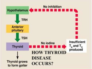 HOW THYROID
DISEASE
OCCURS?
 