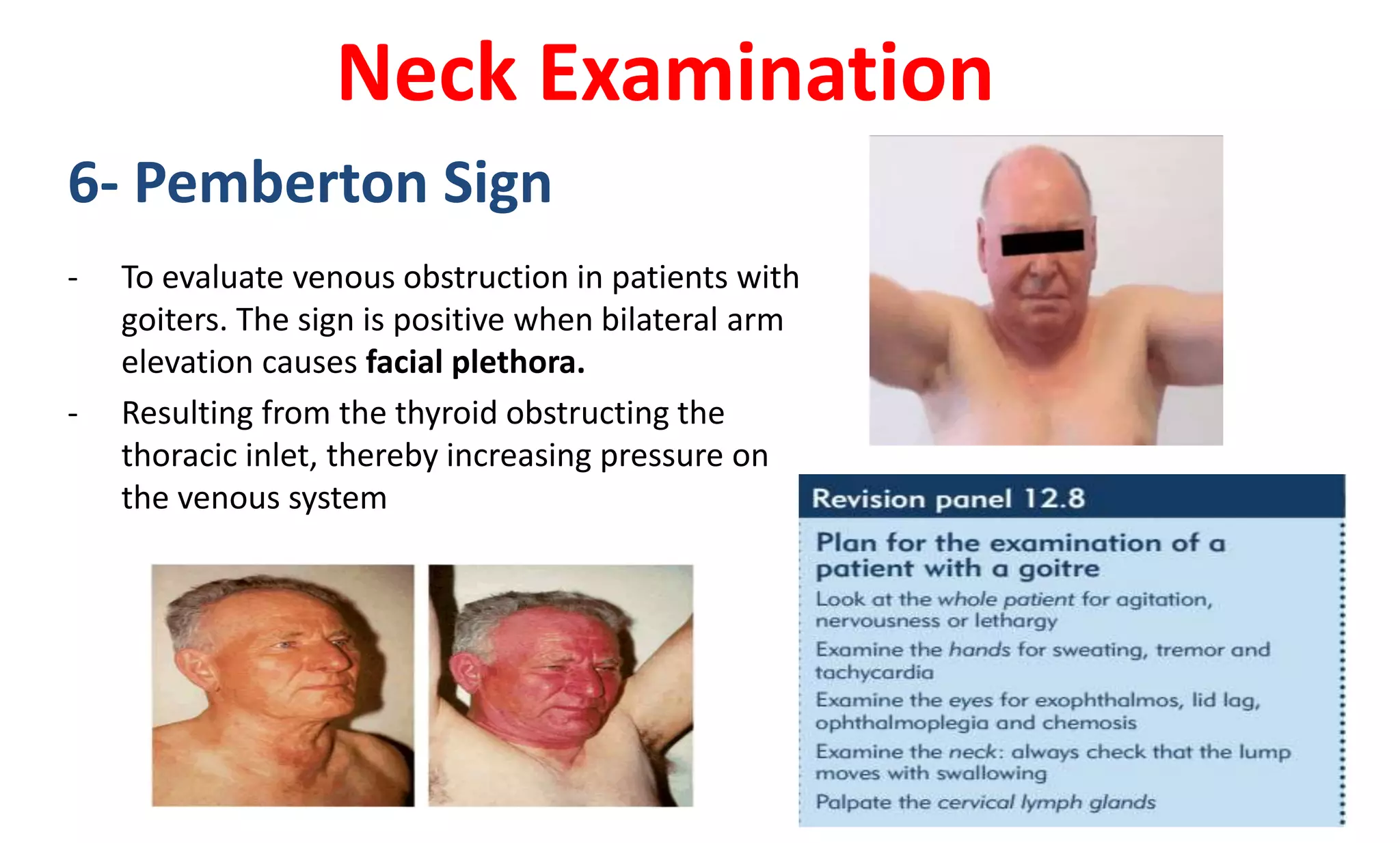 Thyroid History And Physical Examination PPTX Thyroid History And Physical Examination PPTX
