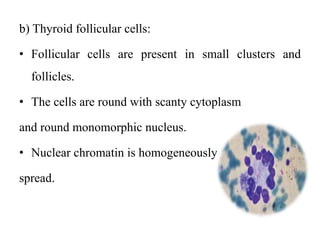 b) Thyroid follicular cells:
• Follicular cells are present in small clusters and
follicles.
• The cells are round with scanty cytoplasm
and round monomorphic nucleus.
• Nuclear chromatin is homogeneously
spread.
 