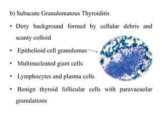 b) Subacute Granulomatous Thyroiditis
• Dirty background formed by cellular debris and
scanty colloid
• Epithelioid cell granulomas
• Multinucleated giant cells
• Lymphocytes and plasma cells
• Benign thyroid follicular cells with paravacuolar
granulations
 