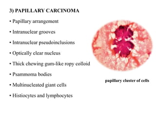 3) PAPILLARY CARCINOMA
• Papillary arrangement
• Intranuclear grooves
• Intranuclear pseudoinclusions
• Optically clear nucleus
• Thick chewing gum-like ropy colloid
• Psammoma bodies
• Multinucleated giant cells
• Histiocytes and lymphocytes
papillary cluster of cells
 