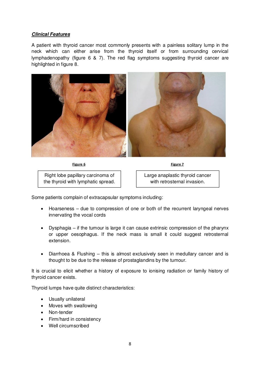 Thyroid Cancer & Differential Diagnosis of Lumps in Neck for Medical