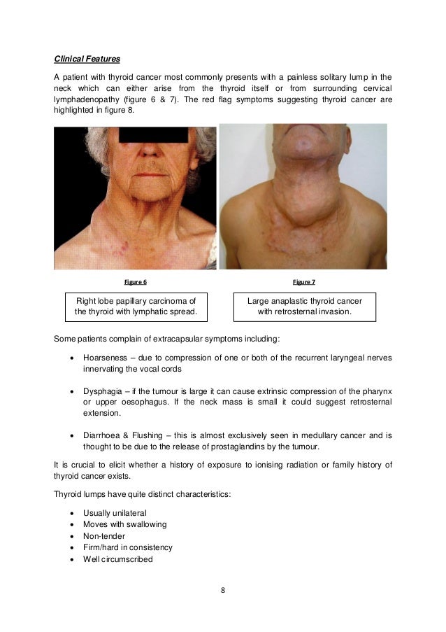 Medullary thyroid carcinoma prognosis grade