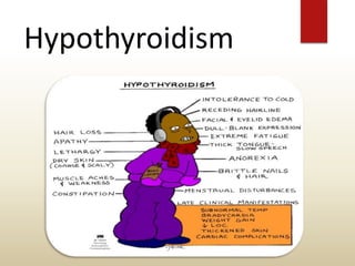 Hypothyroidism
 