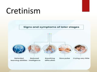Cretinism
 