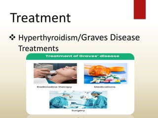 Treatment
 Hyperthyroidism/Graves Disease
Treatments
 