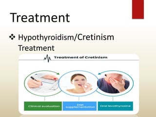 Treatment
 Hypothyroidism/Cretinism
Treatment
 