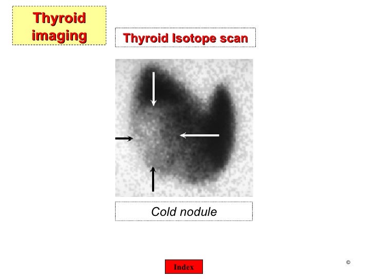 Thyroid presentation