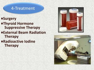 4-Treatment
♦Surgery
♦Thyroid Hormone
Suppressive Therapy
♦External Beam Radiation
Therapy
♦Radioactive Iodine
Therapy
 