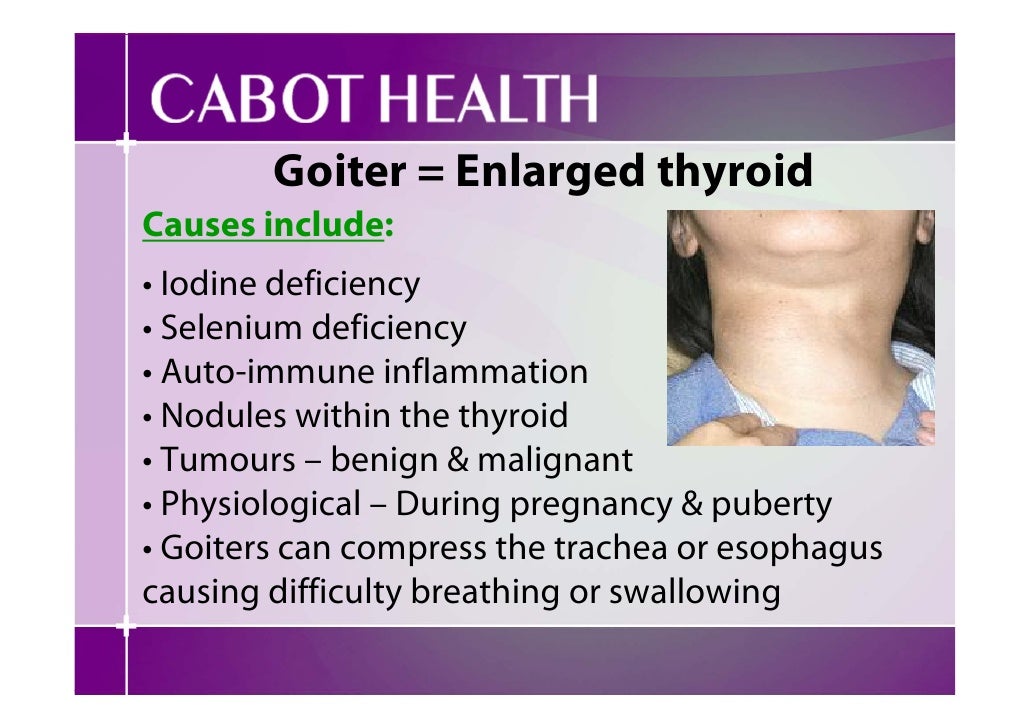How To Treat An Enlarged Thyroid Naturally How To Treat An Enlarged Thyroid Naturally