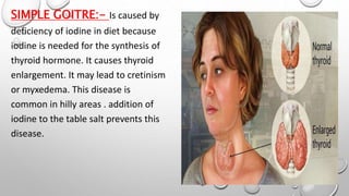 SIMPLE GOITRE:- Is caused by
deficiency of iodine in diet because
iodine is needed for the synthesis of
thyroid hormone. It causes thyroid
enlargement. It may lead to cretinism
or myxedema. This disease is
common in hilly areas . addition of
iodine to the table salt prevents this
disease.
 