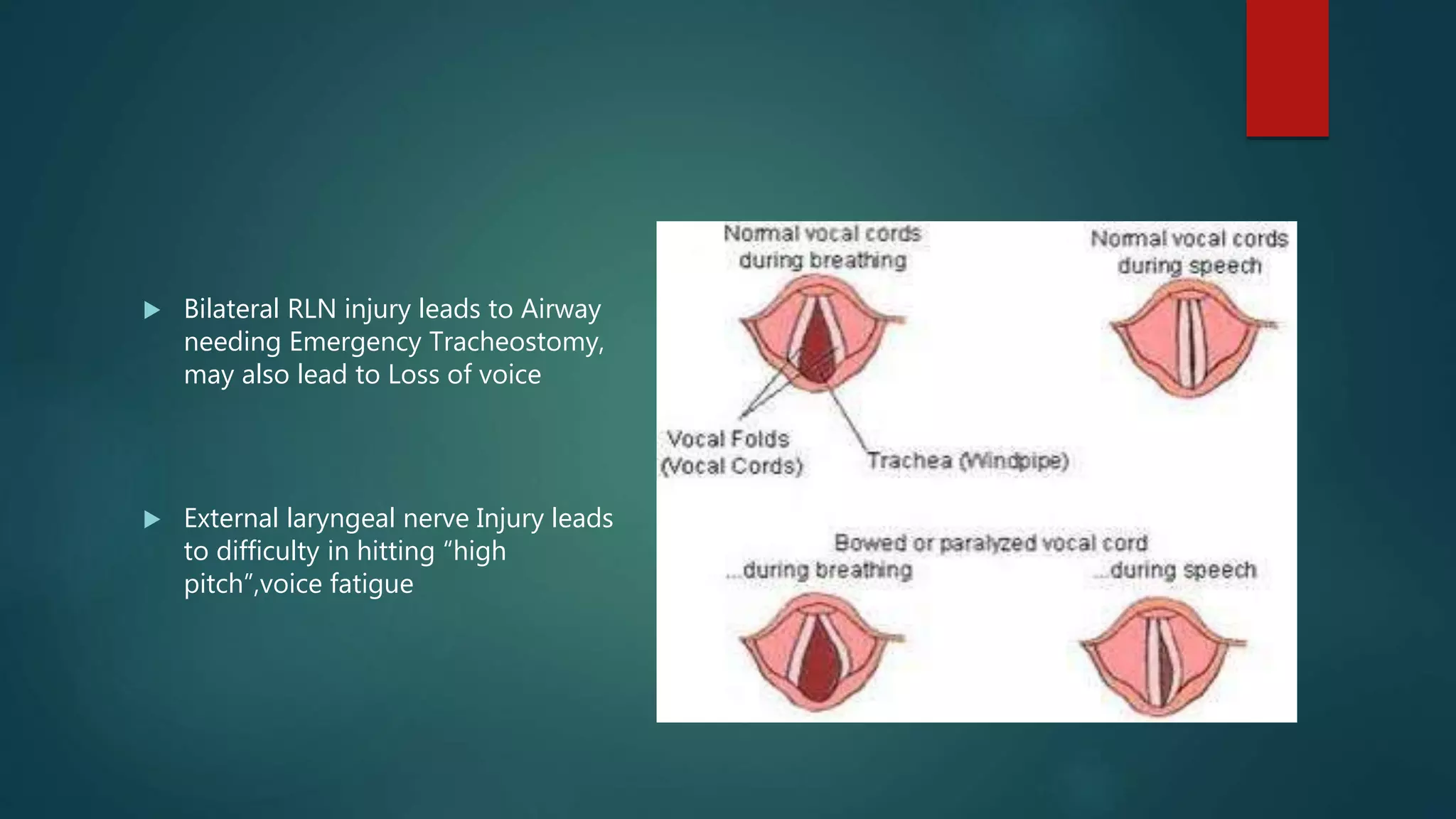 Bilateral Rln Thyroid Anatomy and embryology Simplified | PPTX