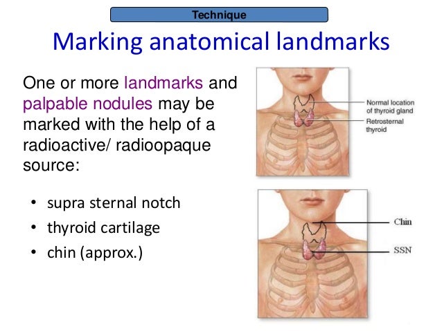 Thyroid anatomy,physiology,thyroid scintigraphy principles