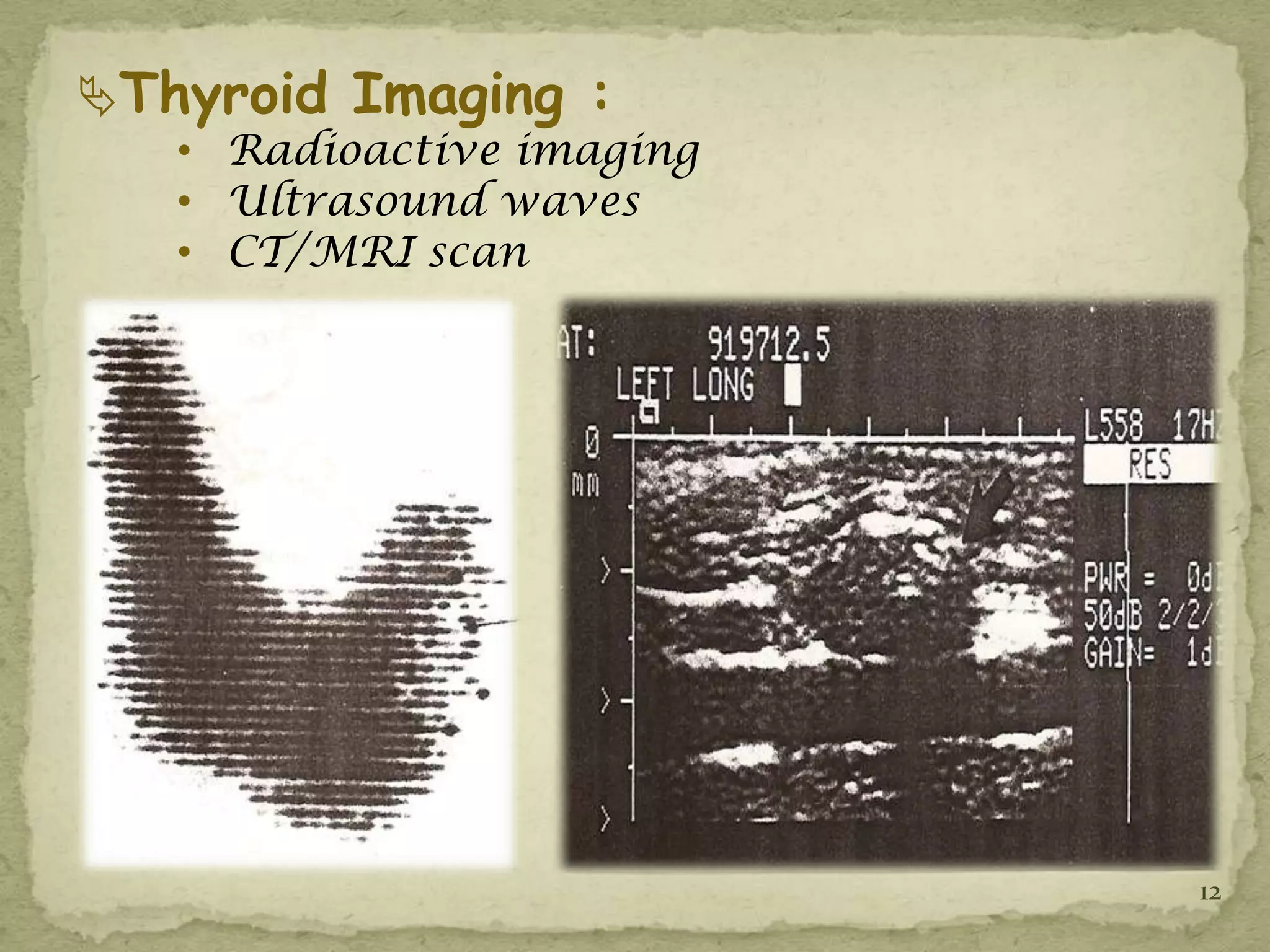 Thyroid Imaging :
   • Radioactive imaging
   • Ultrasound waves
   • CT/MRI scan




                           12
 