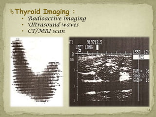 Thyroid Imaging :
   • Radioactive imaging
   • Ultrasound waves
   • CT/MRI scan




                           12
 