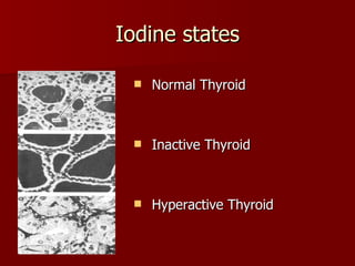 Iodine states Normal Thyroid Inactive Thyroid Hyperactive Thyroid 