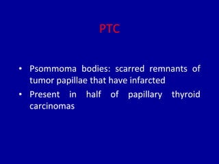PTC
• Psommoma bodies: scarred remnants of
tumor papillae that have infarcted
• Present in half of papillary thyroid
carcinomas
 