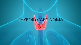 THYROID CARCINOMA
AJITH
GR 4
 