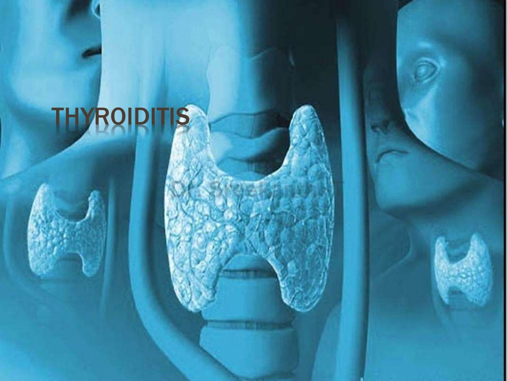 thyroid-disease
