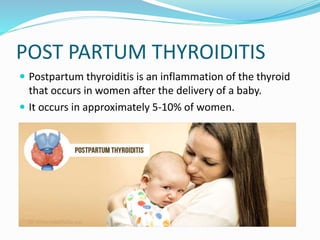POST PARTUM THYROIDITIS
 Postpartum thyroiditis is an inflammation of the thyroid
that occurs in women after the delivery of a baby.
 It occurs in approximately 5-10% of women.
 
