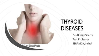 THYROID
DISEASES
Dr. Akshay Shetty
Asst.Professor
SSRAMCH,Inchal
 