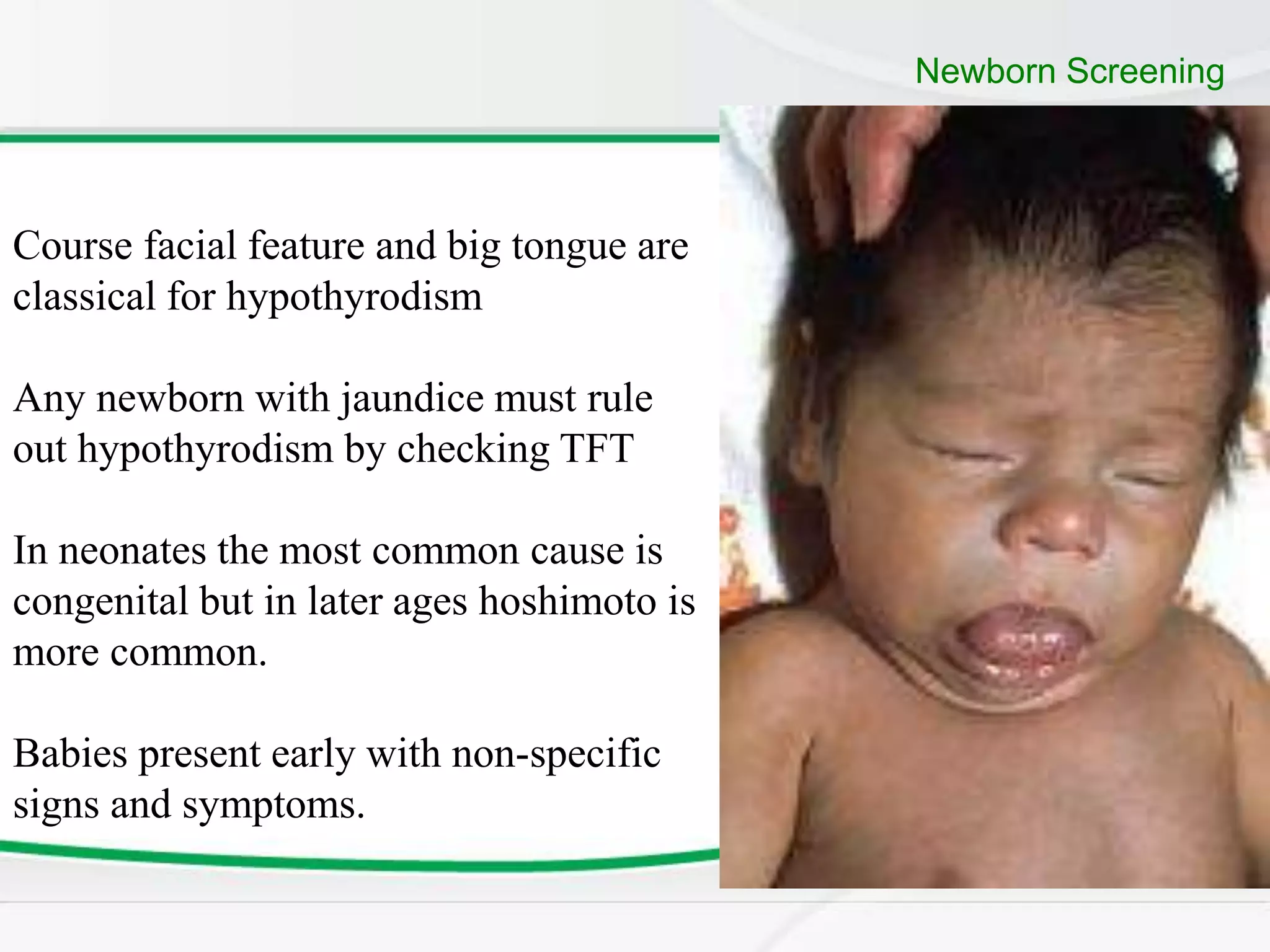 Tft Ranges Newborn Thyroid Diseases.ppt