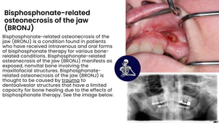 thyroid diseases the descriptions (3).pdf