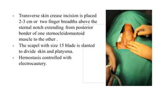 thyroid diseases navya.pptx