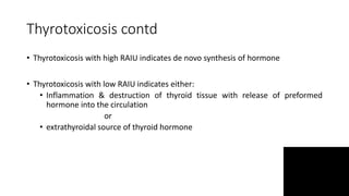 Thyrotoxicosis contd
• Thyrotoxicosis with high RAIU indicates de novo synthesis of hormone
• Thyrotoxicosis with low RAIU indicates either:
• Inflammation & destruction of thyroid tissue with release of preformed
hormone into the circulation
or
• extrathyroidal source of thyroid hormone
 