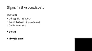 Signs in thyrotoxicosis
Eye signs
• Lid lag, Lid retraction
• Exophthalmos (Graves disease)
• Cranial nerve palsy
• Goitre
• Thyroid bruit
 